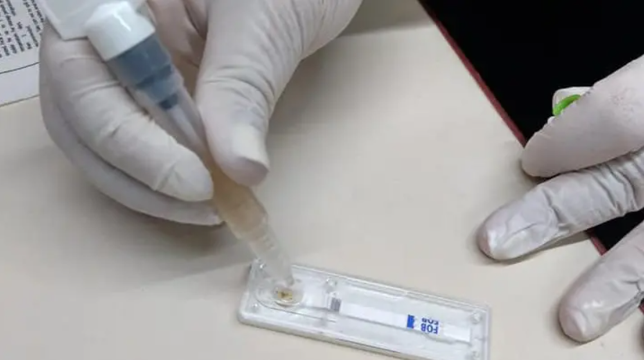 (((video))) Salud ofrece un test gratuito para detección de cáncer colorrectal