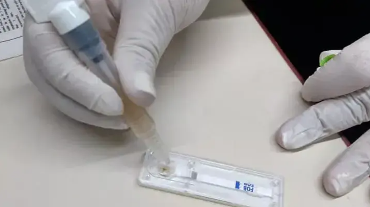 Salud RN ofrece un test de detección de cáncer colorrectal de forma gratuita
